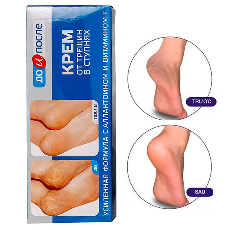 Kem Giảm Nứt Gót Chân Kpem của Nga 50ml