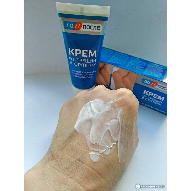 Kem Giảm Nứt Gót Chân Kpem của Nga 50ml