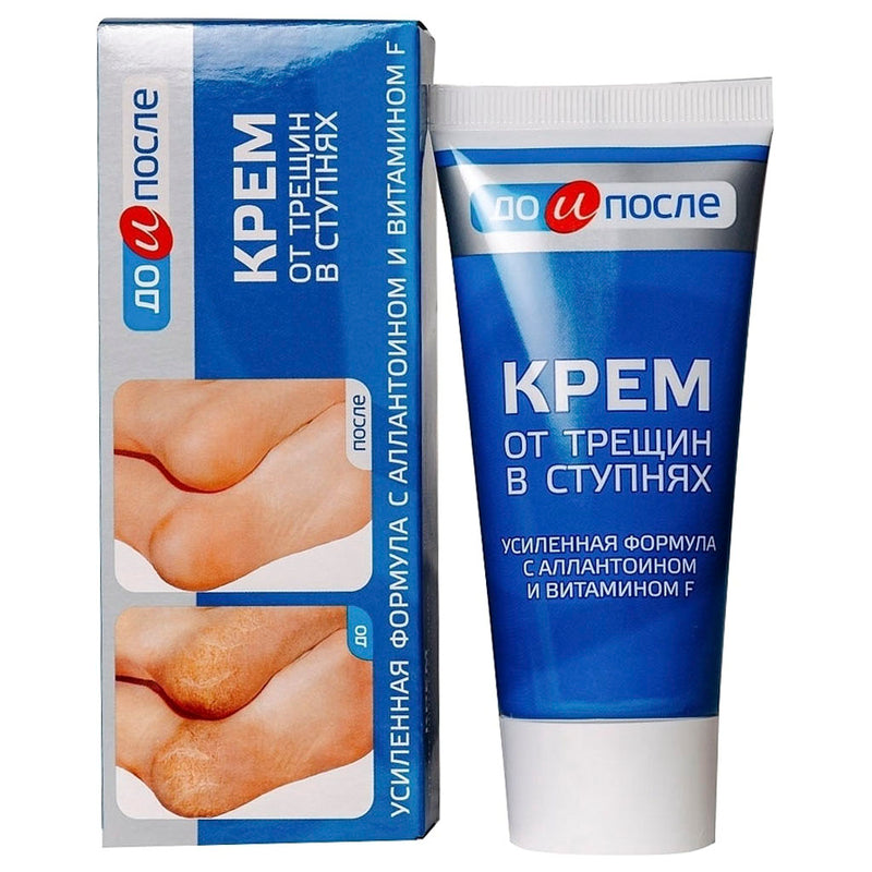 Kem Giảm Nứt Gót Chân Kpem của Nga 50ml