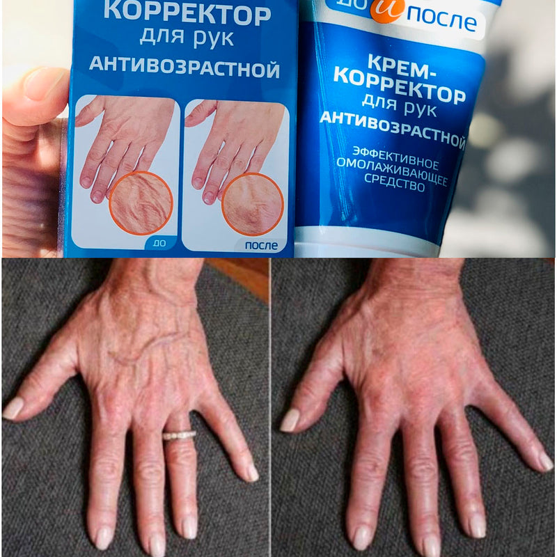 Kem Dưỡng Giảm Gân Tay Kpem của Nga 100ml