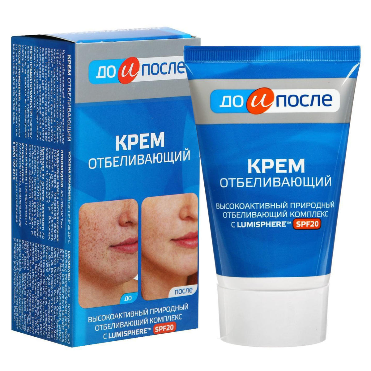 Kem Mờ Nám Đồi Mồi Kpem của Nga 100ml