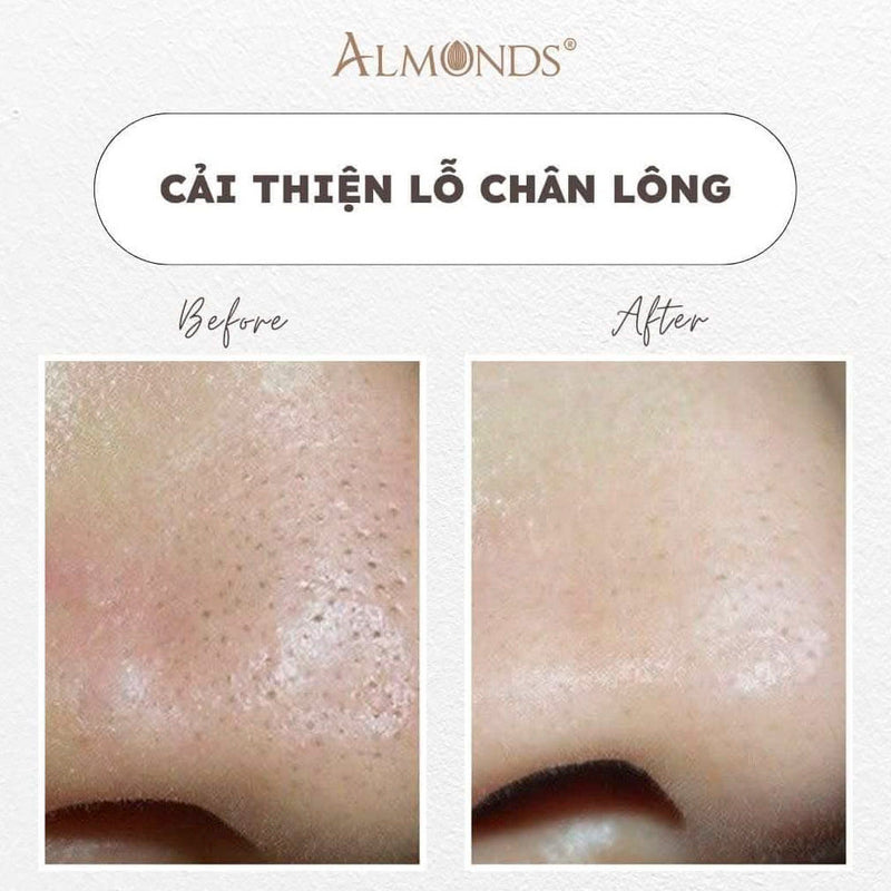Mặt Nạ Thu Nhỏ Lỗ Chân Lông Almonds 50g