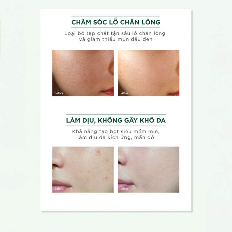 Sữa Rửa Mặt Giảm Mụn Caryophy Portulaca Foam Cleanser 150ml