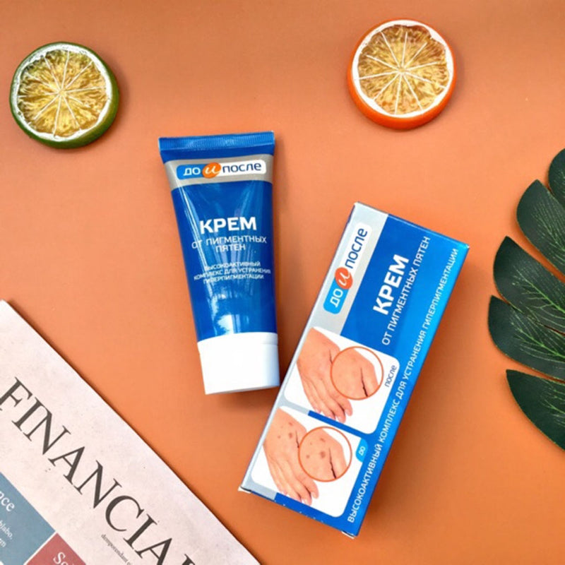 Kem Giảm Đồi Mồi Da Tay Kpem Từ Nga 50ml