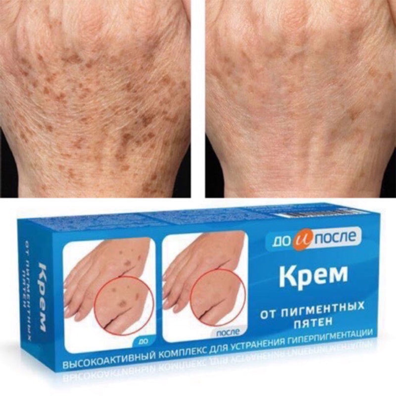 Kem Giảm Đồi Mồi Da Tay Kpem Từ Nga 50ml