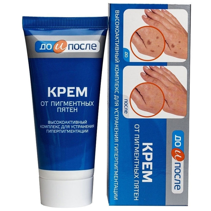 Kem Giảm Đồi Mồi Da Tay Kpem Từ Nga 50ml