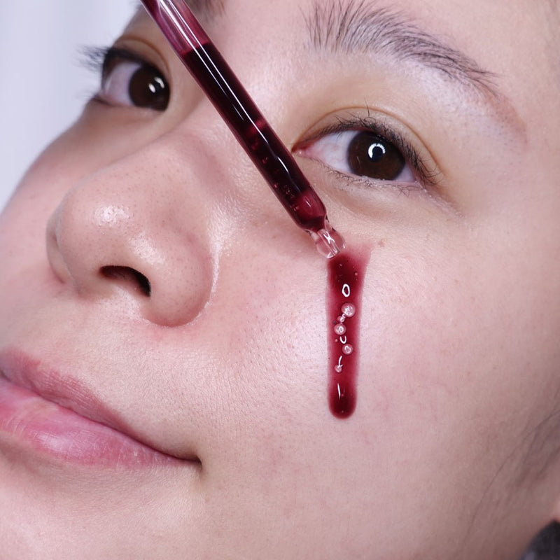 Tẩy Tế Bào Chết So'Natural Red Peel Tingle Serum