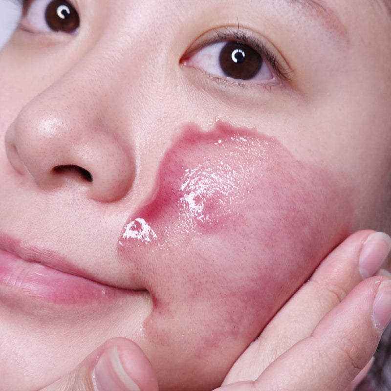 Tẩy Tế Bào Chết So'Natural Red Peel Tingle Serum